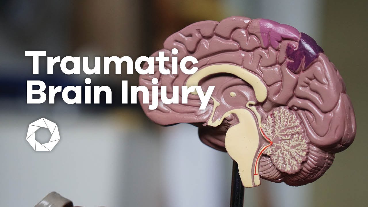 Seven Principles VA Coaching - Traumatic Brain Injury